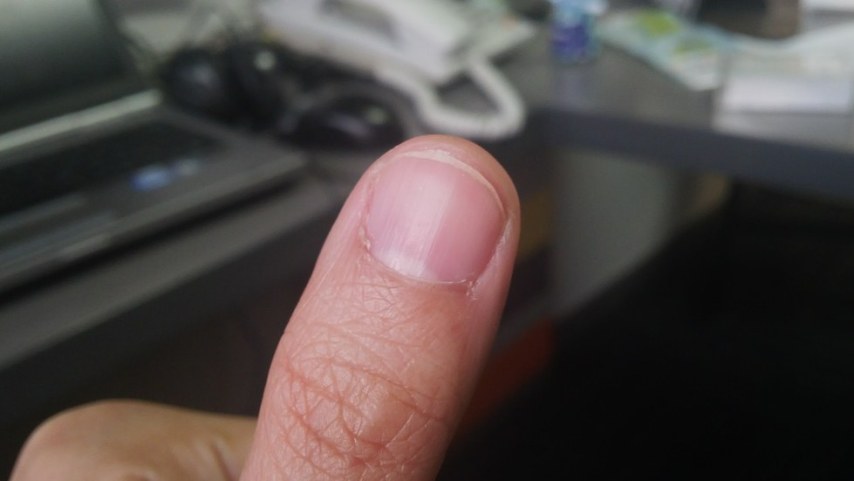 Jempol keren gw. Perhatikan efek blur di belakang.